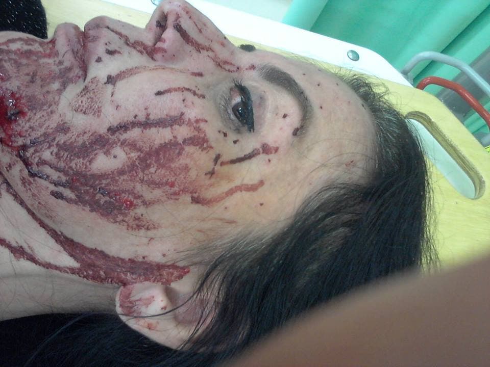 Castrinho e esposa são vítimas de duas tentativas de assalto; veja as imagens postadas no Facebook