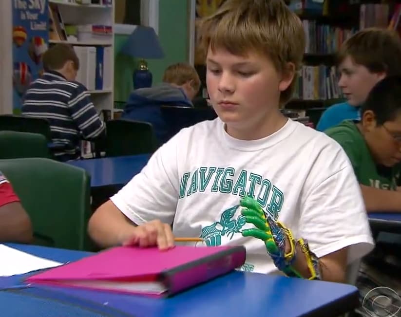 Menino ganha prótese de mão feita por impressora 3D